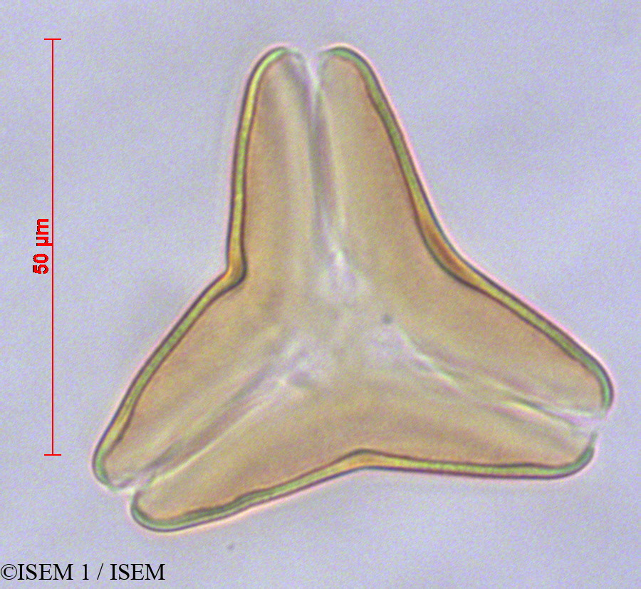 ISEM 1/Tristerix_grandiflorus_29113/Tristerix_grandiflorus_29113_0002(copy).jpg